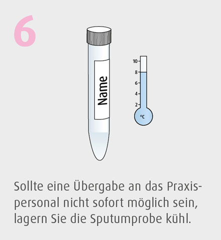 Gewinnung von Sputum 6